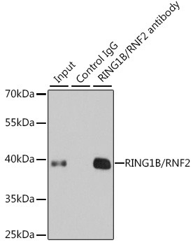 RNF2 Antibody in Immunoprecipitation (IP)