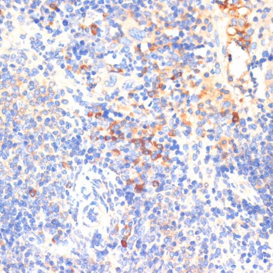 WNK3 Antibody in Immunohistochemistry (Paraffin) (IHC (P))