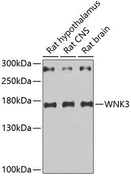 WNK3 Antibody in Western Blot (WB)