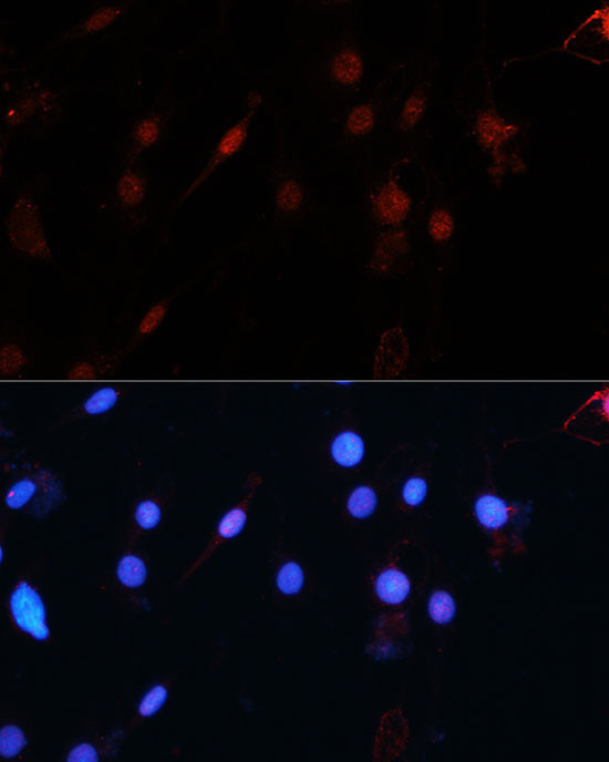 ZEB1 Antibody in Immunocytochemistry (ICC/IF)