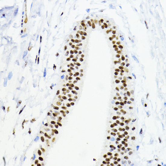 ZEB1 Antibody in Immunohistochemistry (Paraffin) (IHC (P))