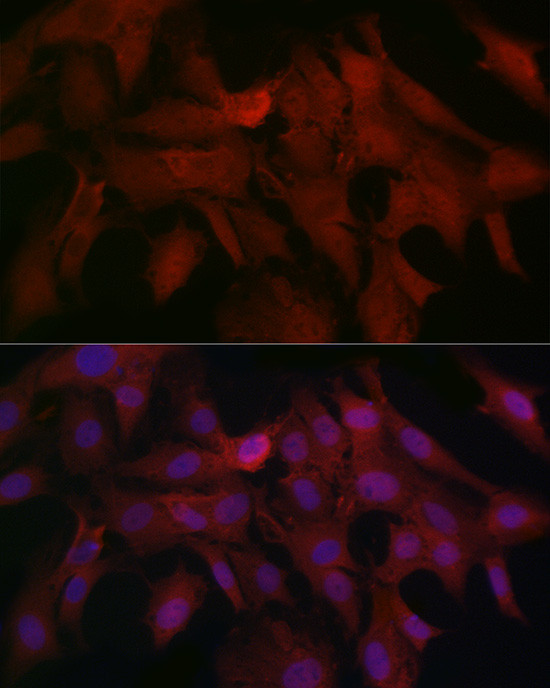 SMAD4 Antibody in Immunocytochemistry (ICC/IF)