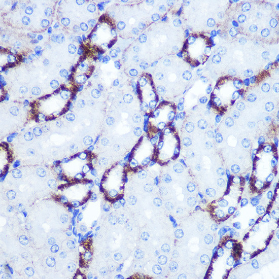 SMAD4 Antibody in Immunohistochemistry (Paraffin) (IHC (P))