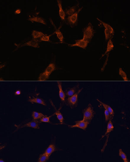 IQGAP1 Antibody in Immunocytochemistry (ICC/IF)