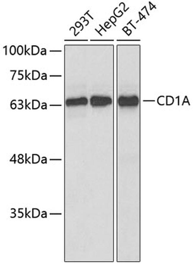 CD1a Antibody in Western Blot (WB)