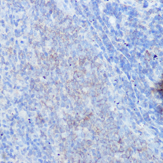 IFNGR1 Antibody in Immunohistochemistry (Paraffin) (IHC (P))