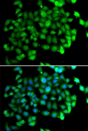 APOBEC3C Antibody in Immunocytochemistry (ICC/IF)