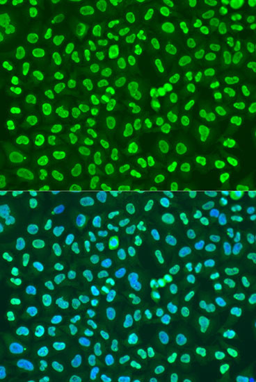 PTBP1 Antibody in Immunocytochemistry (ICC/IF)