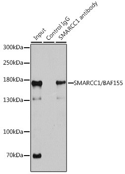 SMARCC1 Antibody in Immunoprecipitation (IP)