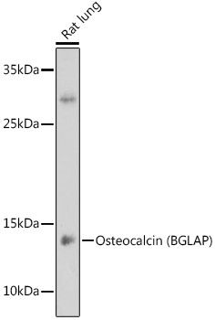 Osteocalcin Antibody in Western Blot (WB)