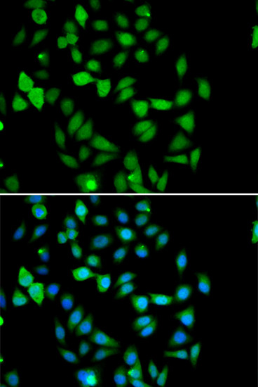 STAMBP Antibody in Immunocytochemistry (ICC/IF)