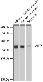 ART5 Antibody in Western Blot (WB)