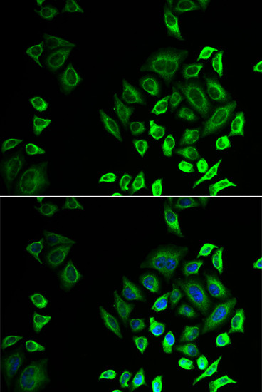 PLA2G2D Antibody in Immunocytochemistry (ICC/IF)