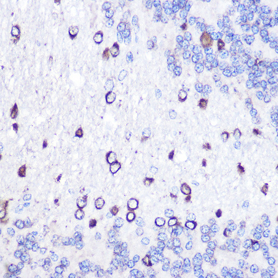 GOLPH2 Antibody in Immunohistochemistry (Paraffin) (IHC (P))