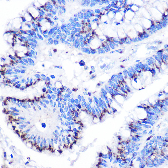 GOLPH2 Antibody in Immunohistochemistry (Paraffin) (IHC (P))