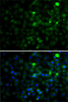 SMYD4 Antibody in Immunocytochemistry (ICC/IF)