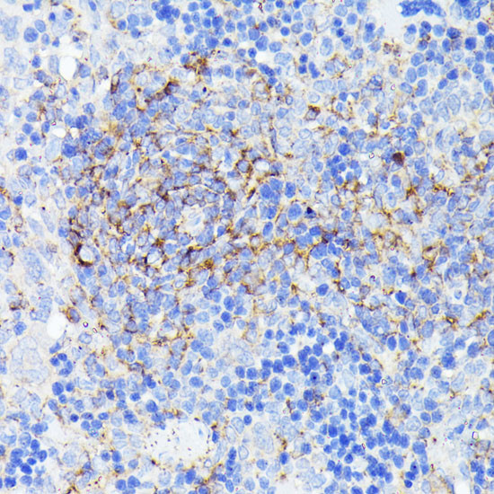 SMYD4 Antibody in Immunohistochemistry (Paraffin) (IHC (P))