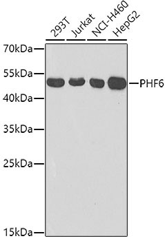 PHF6 Antibody in Western Blot (WB)