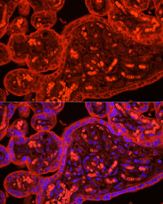 ATG9B Antibody in Immunocytochemistry (ICC/IF)