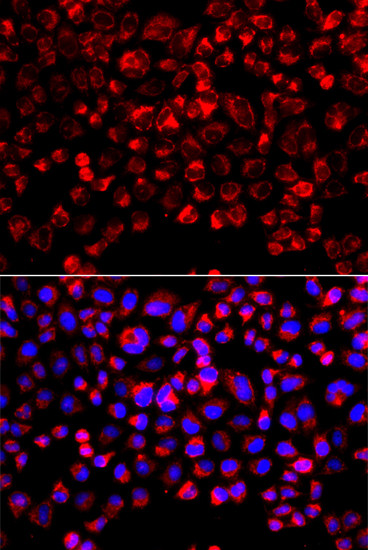 SULT1E1 Antibody in Immunocytochemistry (ICC/IF)