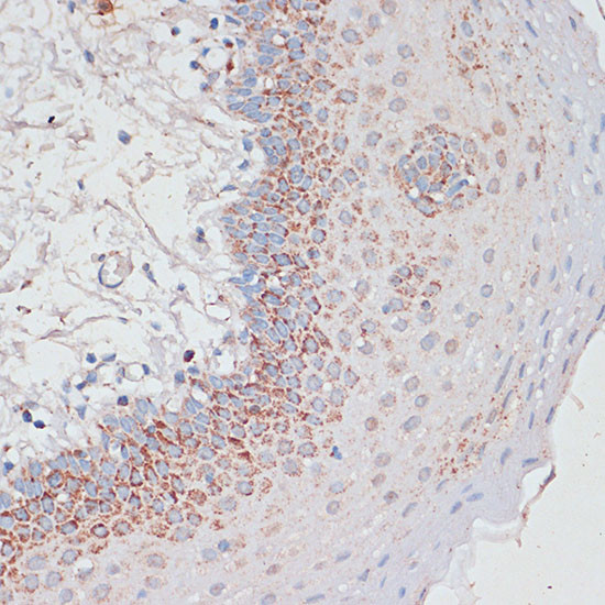 Desmoplakin Antibody in Immunohistochemistry (Paraffin) (IHC (P))