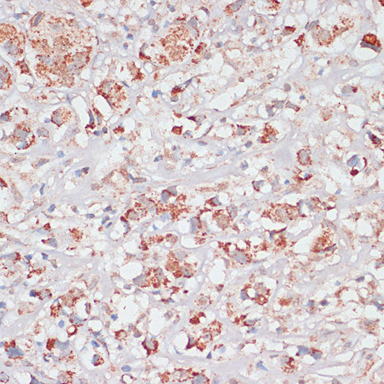 Desmoplakin Antibody in Immunohistochemistry (Paraffin) (IHC (P))