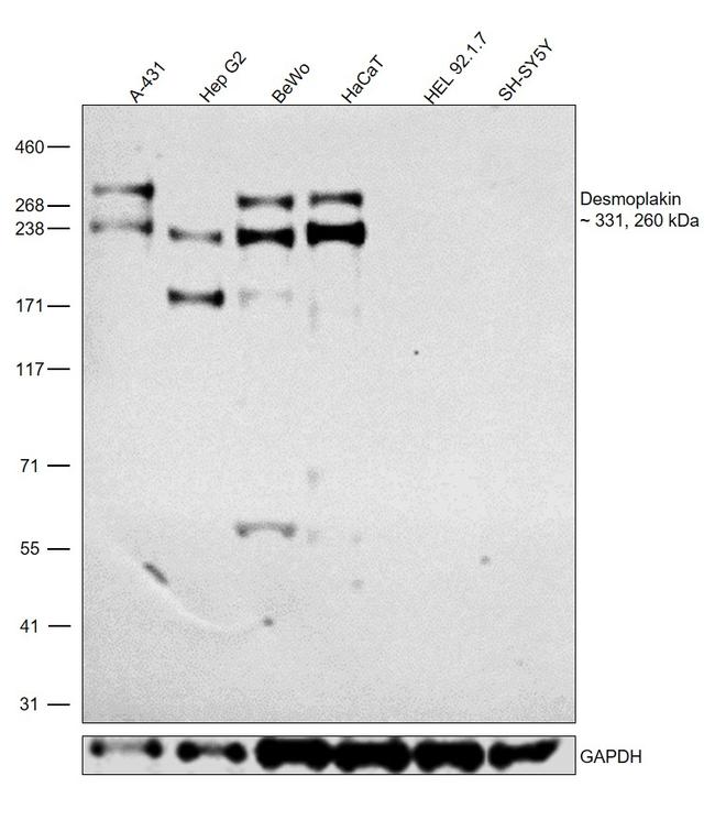 Desmoplakin Antibody in Western Blot (WB)