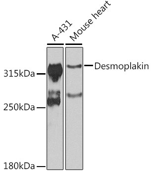 Desmoplakin Antibody in Western Blot (WB)