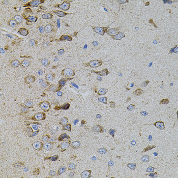 p38 MAPK beta Antibody in Immunohistochemistry (Paraffin) (IHC (P))