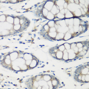 TNNC2 Antibody in Immunohistochemistry (Paraffin) (IHC (P))