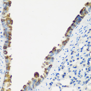 TNNC2 Antibody in Immunohistochemistry (Paraffin) (IHC (P))