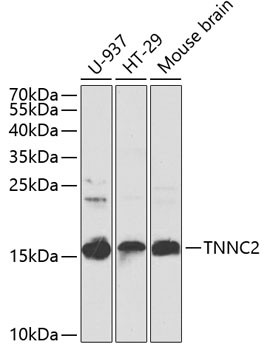 TNNC2 Antibody in Western Blot (WB)