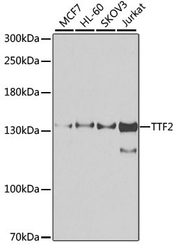 TTF2 Antibody in Western Blot (WB)