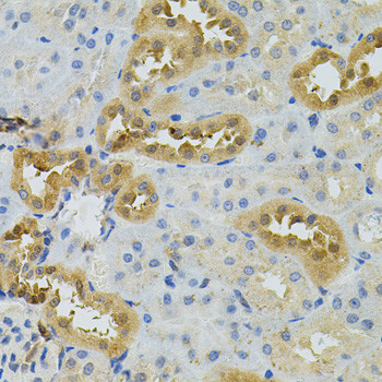 NAT8 Antibody in Immunohistochemistry (Paraffin) (IHC (P))