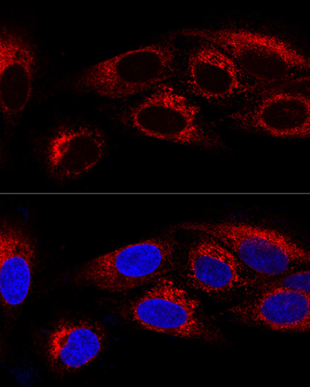 CKAP4 Antibody in Immunocytochemistry (ICC/IF)