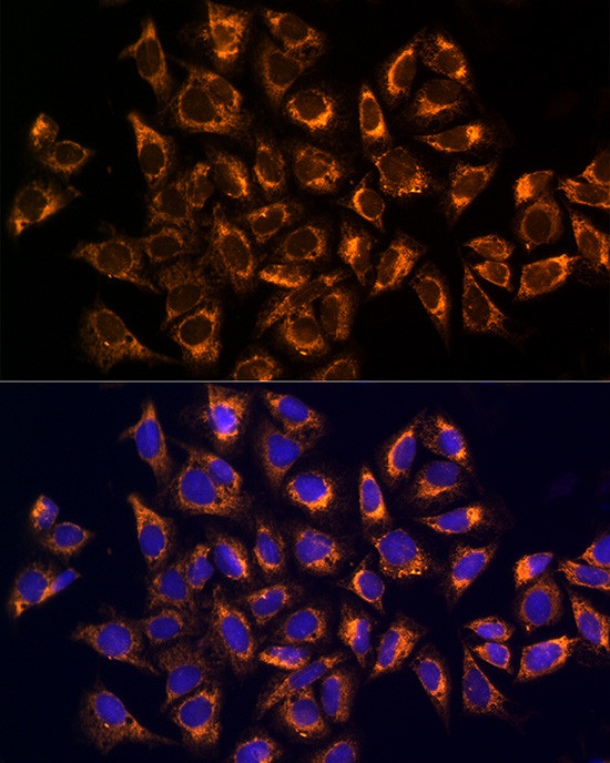 CKAP4 Antibody in Immunocytochemistry (ICC/IF)