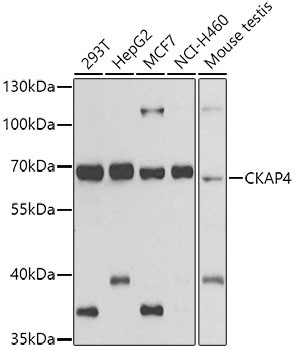 CKAP4 Antibody in Western Blot (WB)