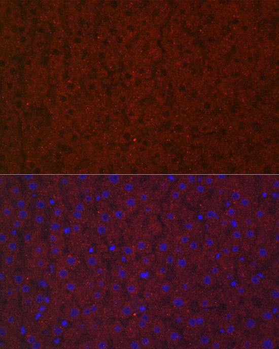 LRG1 Antibody in Immunocytochemistry (ICC/IF)