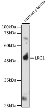 LRG1 Antibody in Western Blot (WB)