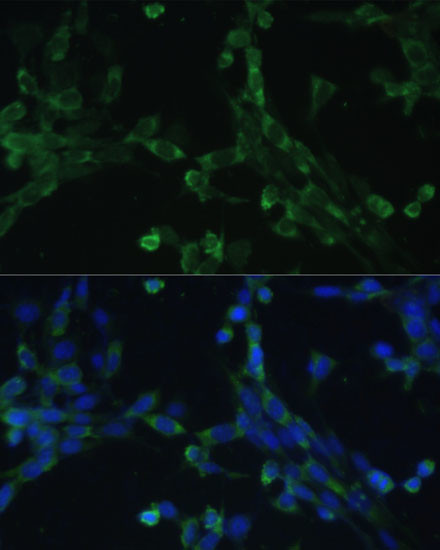 EEF1G Antibody in Immunocytochemistry (ICC/IF)