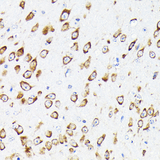 EEF1G Antibody in Immunohistochemistry (Paraffin) (IHC (P))