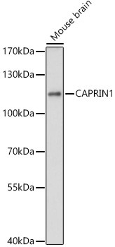 GPIP137 Antibody in Western Blot (WB)