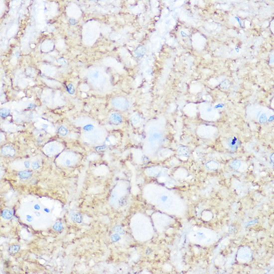 CD56 Antibody in Immunohistochemistry (Paraffin) (IHC (P))