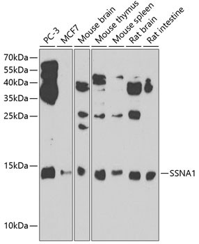 SSNA1 Antibody in Western Blot (WB)