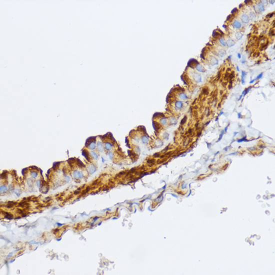 MYLK Antibody in Immunohistochemistry (Paraffin) (IHC (P))