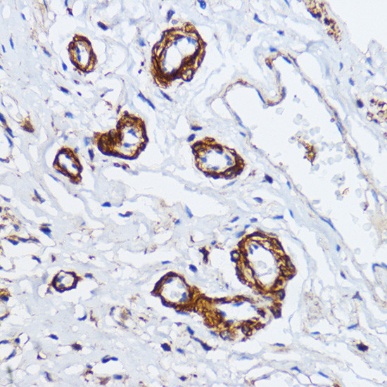 MYLK Antibody in Immunohistochemistry (Paraffin) (IHC (P))