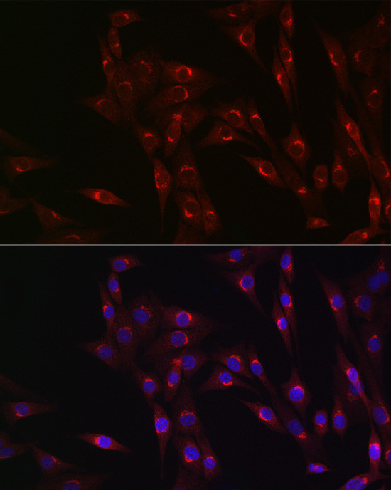 MR1 Antibody in Immunocytochemistry (ICC/IF)