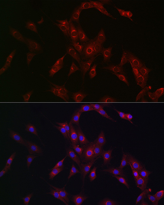 MR1 Antibody in Immunocytochemistry (ICC/IF)