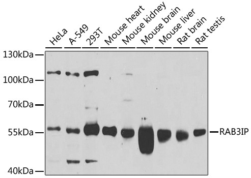 RAB3IP Antibody in Western Blot (WB)