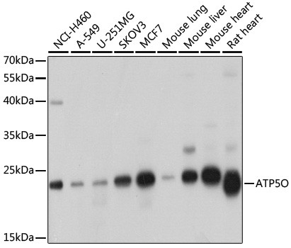 ATP Synthase O Antibody in Western Blot (WB)